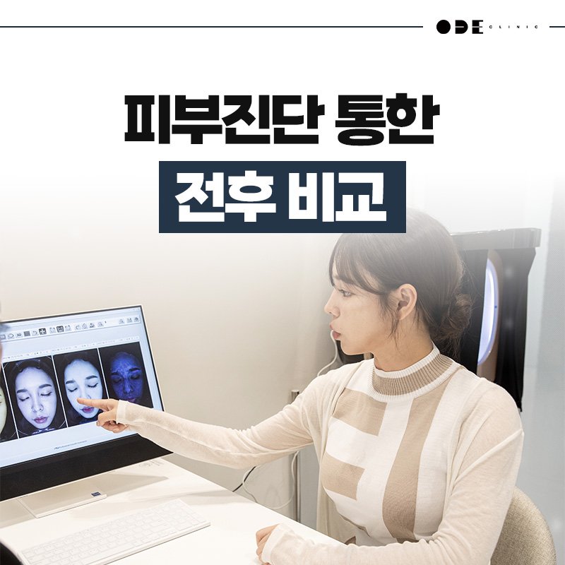 시술 경험